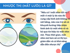NHƯỢC THỊ - ĐẾN ĐÔI MẮT CŨNG CÓ THỂ LƯỜI !!