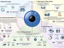 Bệnh Glaucoma (cườm nước) - "kẻ cắp thị giác thầm lặng" và những điều bạn cần biết