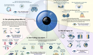 Bệnh Glaucoma (cườm nước) - "kẻ cắp thị giác thầm lặng" và những điều bạn cần biết