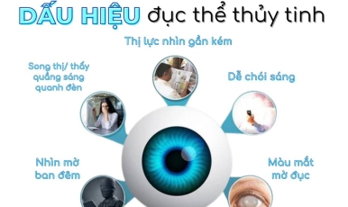 NÂNG CAO NHẬN THỨC VỀ BỆNH LÝ ĐỤC THỂ THỦY TINH