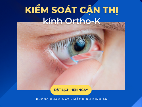 KIỂM SOÁT CẬN THỊ BẰNG KÍNH ORTHO-K
